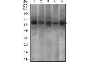 Western blot analysis using PDE1B mouse mAb against A549 (1), SK-MES-1 (2), PC-12 (4),3T3L1 (5) cell lysate and Mouse brain (3) tissue lysate.