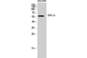 Western Blotting (WB) image for anti-G Protein-Coupled Receptor 114 (GPR114) (Internal Region) antibody (ABIN3184837)