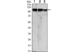 Western blot analysis using HK2 mouse mAb against Jurkat (1), Hela (2) and HEK293 (3) cell lysate. (Hexokinase 2 Antikörper)