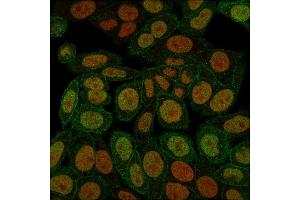 Immunofluorescence (IF) image for anti-Annexin A1 (ANXA1) antibody (ABIN6939608)