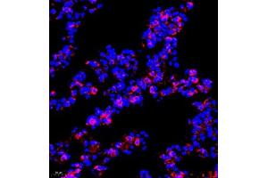 Immunofluorescence of paraffin embedded mouse lung using P4H (ABIN7074215) at dilution of 1:700 (400x lens) (HIF Prolyl Hydroxylase Antikörper)