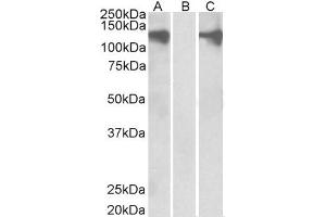Western Blotting (WB) image for anti-Pumilio Homolog 2 (Drosophila) (PUM2) antibody (ABIN5930779) (PUM2 Antikörper)