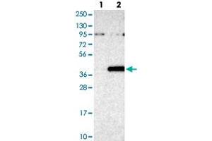 Western blot analysis of Lane 1: Negative control (vector only transfected HEK293T lysate), Lane 2: Over-expression Lysate (Co-expressed with a C-terminal myc-DDK tag (~3. (ZNF177 Antikörper)