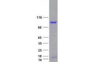 Western Blotting (WB) image for Adenosine Deaminase, RNA-Specific, B1 (ADARB1) (Transcript Variant 2) protein (Myc-DYKDDDDK Tag) (ABIN2714395)