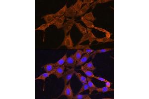 Immunofluorescence analysis of NIH/3T3 cells using NMN Rabbit pAb (ABIN7268910) at dilution of 1:100.