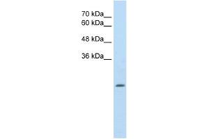 WB Suggested Anti-ALDH4A1 Antibody Titration:  2. (ALDH4A1 Antikörper  (N-Term))