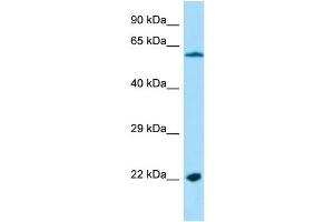 Host: Rabbit Target Name: MRPL4 Sample Type: HepG2 Whole Cell lysates Antibody Dilution: 1.