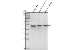Western blot analysis of FLI1 using anti-FLI1 antibody (AZA0A8M9PLW9).