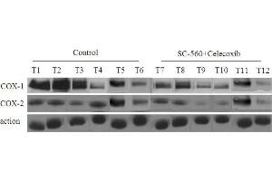 COX protein levels in xenograft tumors of nude mice treated or not treated with combined treatment of SC-560 and celecoxib.