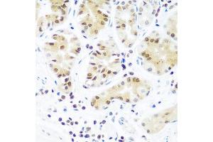 Immunohistochemistry of paraffin-embedded human stomach using AGO2 antibody at dilution of 1:100 (40x lens). (AGO2 Antikörper)