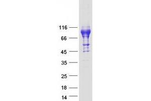 Western Blotting (WB) image for Interleukin 6 Receptor (IL6R) (Transcript Variant 1) protein (Myc-DYKDDDDK Tag) (ABIN2713400)