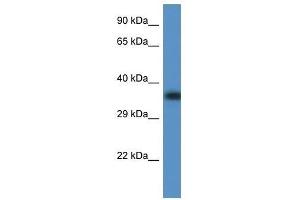 Western Blot showing Fbxo32 antibody used at a concentration of 1.