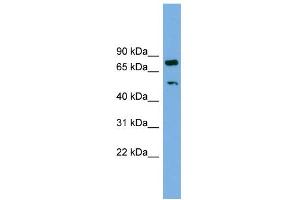 WB Suggested Anti-RBM42 Antibody Titration: 0. (RBM42 Antikörper  (Middle Region))