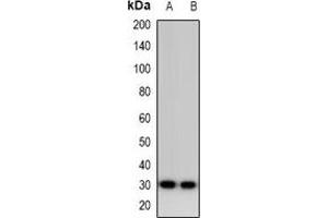 Western blot analysis of Calsarcin 1 expression in HepG2 (A), MDAMB453 (B) whole cell lysates. (MYOZ2 Antikörper)