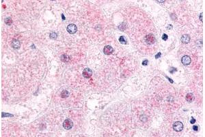 Immunohistochemistry (IHC) image for anti-Nuclear Receptor Subfamily 0, Group B, Member 2 (NR0B2) (Ligand Binding Domain) antibody (ABIN1049128)