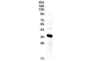 Western blot testing of human HepG2 cell lysate with IGFBP2 antibody at 0.