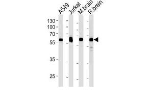 Western Blotting (WB) image for anti-Ubiquitin Specific Peptidase 14 (USP14) antibody (ABIN3004701) (USP14 Antikörper)