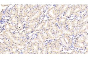 Detection of SAP in Rat Kidney Tissue using Polyclonal Antibody to Serum Amyloid P Component (SAP) (APCS Antikörper  (AA 22-222))