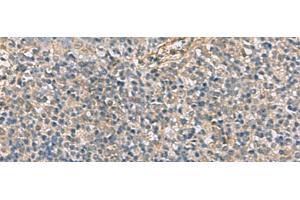 Immunohistochemistry of paraffin-embedded Human tonsil tissue using APOBR Polyclonal Antibody at dilution of 1:35(x200) (APOBR Antikörper)