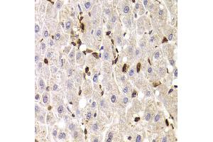 Immunohistochemistry of paraffin-embedded human liver injury using SPN antibody (ABIN5973813) at dilution of 1/100 (40x lens). (CD43 Antikörper)