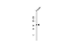 Anti-CEAC Antibody (N-term) at 1:1000 dilution + human brain lysate Lysates/proteins at 20 μg per lane. (CEACAM18 Antikörper  (N-Term))