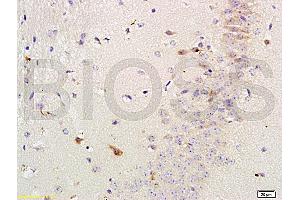 Formalin-fixed and paraffin-embedded mouse brain labeled with Rabbit Anti-Versican Polyclonal Antibody, Unconjugated (ABIN741660) 1:200 followed by conjugation to the secondary antibody and DAB staining