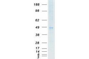 Western Blotting (WB) image for Endothelin Receptor Type B (EDNRB) (Transcript Variant 1) protein (Myc-DYKDDDDK Tag) (ABIN2720180)