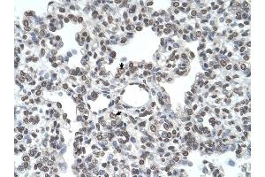 TMPRSS11D antibody was used for immunohistochemistry at a concentration of 4-8 ug/ml to stain Alveolar cells (arrows) in Human Lung.