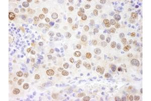 Immunohistochemistry (IHC) image for anti-High Mobility Group Nucleosome Binding Domain 1 (HMGN1) (AA 90-100) antibody (ABIN7448975) (HMGN1 Antikörper  (AA 90-100))
