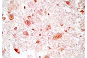 Immunohistochemistry (IHC) image for anti-Neuropeptide S (NPS) (AA 23-67), (Preproprotein) antibody (ABIN2873037)