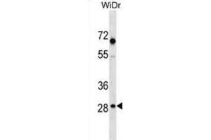 Western Blotting (WB) image for anti-Sorting Nexin 11 (SNX11) antibody (ABIN3000505) (SNX11 Antikörper)