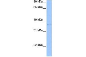 TREML2 antibody used at 1 ug/ml to detect target protein.