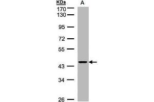 WB Image Sample(30 ug whole cell lysate) A:H1299 10% SDS PAGE antibody diluted at 1:1000