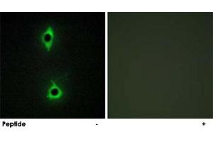 Immunofluorescence analysis of COS-7 cells, using PIKFYVE polyclonal antibody .