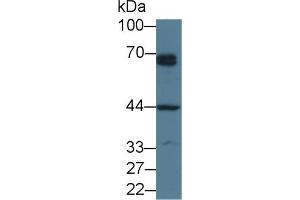 Western Blot; Sample: Human Hela cell lysate; Primary Ab: 3µg/ml Rabbit Anti-Human PTHR1 Antibody Second Ab: 0.