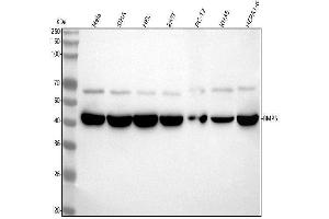 Western blot analysis of BMP6 using anti-BMP6 antibody (ABIN7604144).