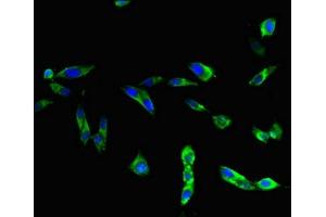 Immunofluorescent analysis of Hela cells using ABIN7172270 at dilution of 1:100 and Alexa Fluor 488-congugated AffiniPure Goat Anti-Rabbit IgG(H+L) (TLR3 Antikörper  (AA 135-297))