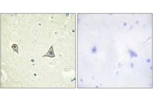 Immunohistochemistry analysis of paraffin-embedded human brain tissue, using M-CSF Receptor (Ab-723) Antibody. (CSF1R Antikörper  (AA 691-740))