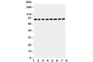 Western blot testing of Factor VIII antbody; Lane 1: A431;  2: HeLa;  3: SMMC-7721;  4: Jurkat;  5: Raji;  6: CEM;  7: HL-60;  8: MCF-7 cell lysate (Factor VIII Antikörper  (Middle Region))