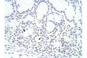 ZNF580 antibody was used for immunohistochemistry at a concentration of 4-8 ug/ml to stain Epithelial cells of fundic gland (arrows) in Human Stomach. (ZNF580 Antikörper  (N-Term))