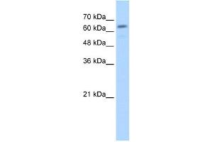WB Suggested Anti-GUSB Antibody Titration:  2. (Glucuronidase beta Antikörper  (C-Term))