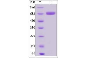 SDS-PAGE (SDS) image for CD200 (CD200) (AA 31-232) protein (Fc Tag,AVI tag,Biotin) (ABIN5954959)