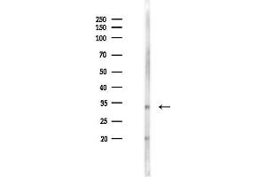 Western blot analysis of lysates from F10-LUC cells(starvation 24h treatment), using FAM181A Antibody at 1/1000 dilution. (FAM181A Antikörper)