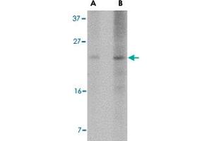 Western blot analysis of BBC3 expression in K-562 cell lysate with BBC3 monoclonal antibody, clone 2A8F6  at (A) 2. (PUMA Antikörper  (AA 76-170))