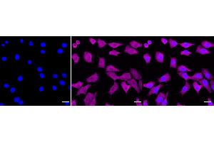 Immunocytochemical staining of C2C12 cells with Galectin 1 antibody (ABIN7799243), 1:1,000).