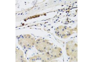 Immunohistochemistry of paraffin-embedded human gastric using MB21D1 antibody at dilution of 1:100 (x40 lens).