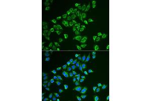 Immunofluorescence analysis of HeLa cells using TAGLN antibody. (Transgelin Antikörper  (AA 1-201))