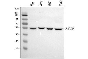 Western blot analysis of RTCB using anti-RTCB antibody (ABIN7600722).