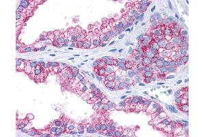 Anti-EPB41L2 antibody IHC of human prostate. (EPB41L2 Antikörper  (AA 481-530))