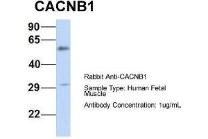 Host:  Rabbit  Target Name:  CACNB1  Sample Type:  Human Fetal Muscle  Antibody Dilution:  1. (CACNB1 Antikörper  (Middle Region))